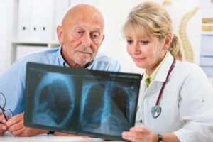 Are You at Risk for Lung Cancer?