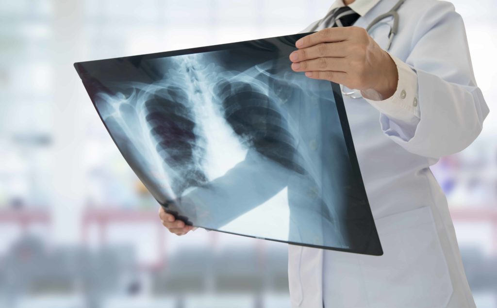 X Ray Show Low Az Extremity X Ray Snowflake