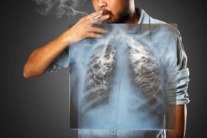 Man smoking a cigarette with lung imaging graphic overlay.
