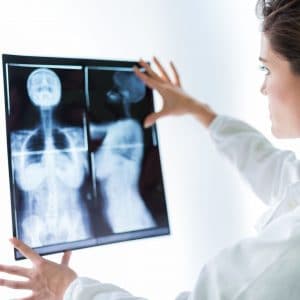 Why are mammograms important?