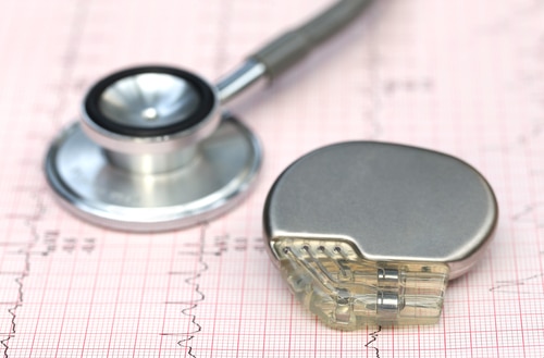 Close up of electrocardiograph with stethoscope and pacemaker