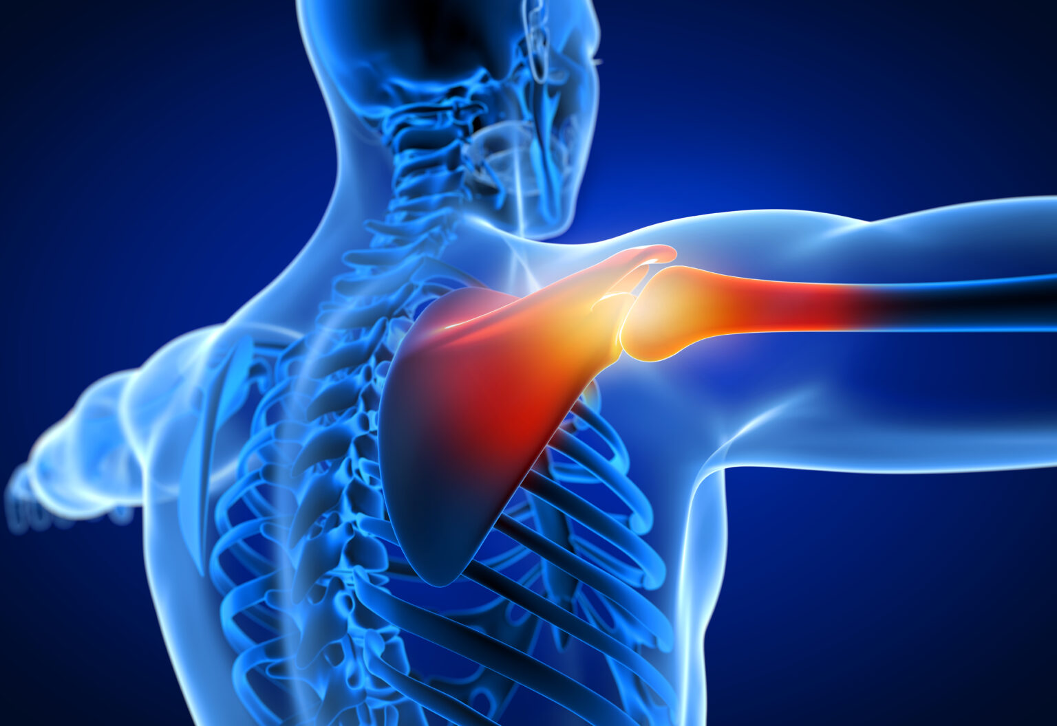 major-signs-that-you-may-need-shoulder-surgery