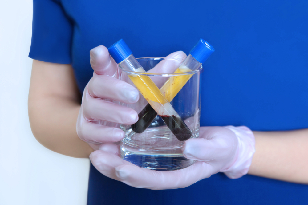 Nurse holding two vials of blood for testing at the lab in Show Low, AZ