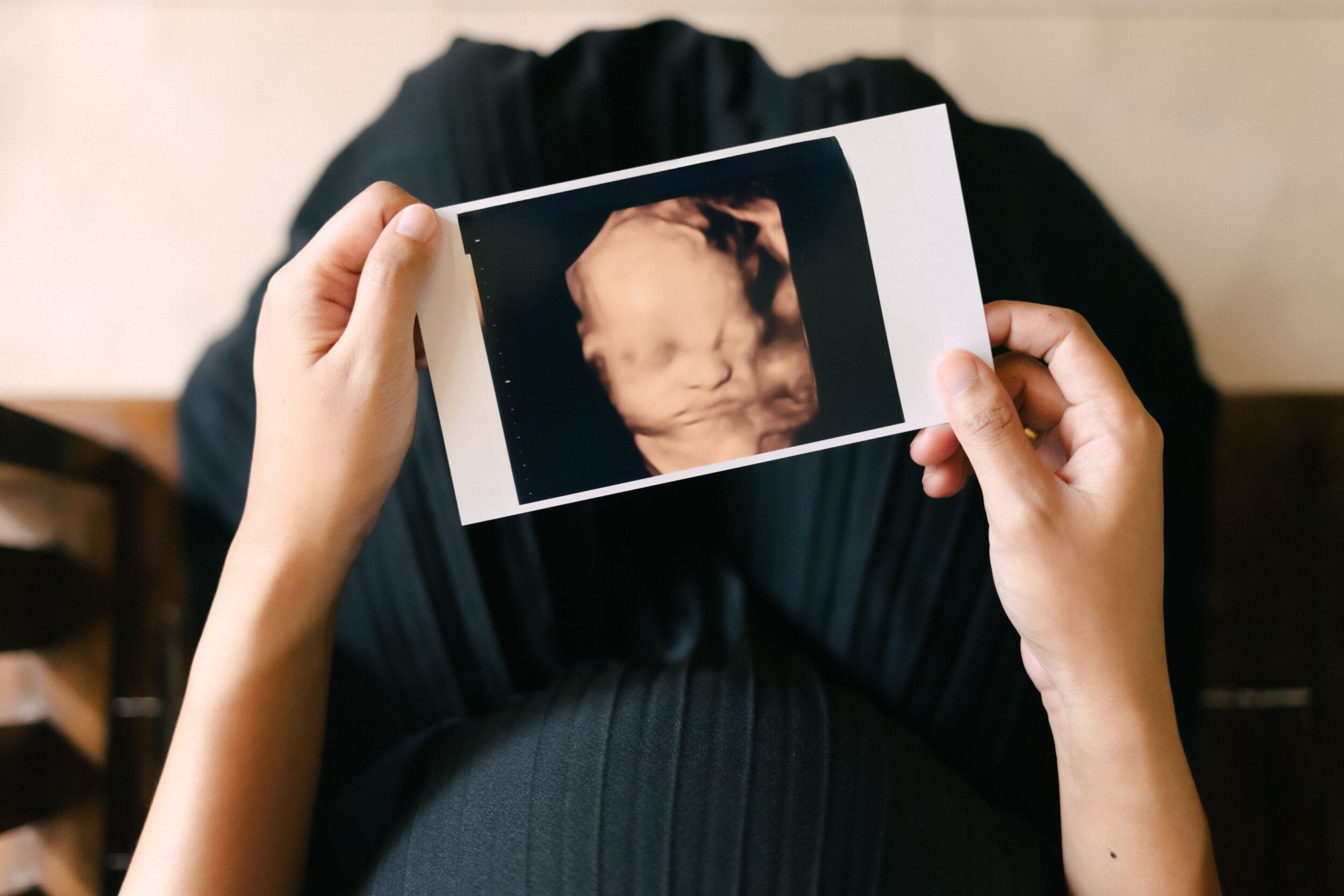 A,Pregnant,Woman,Holding,4d,Scan,Result,Of,Her,Baby